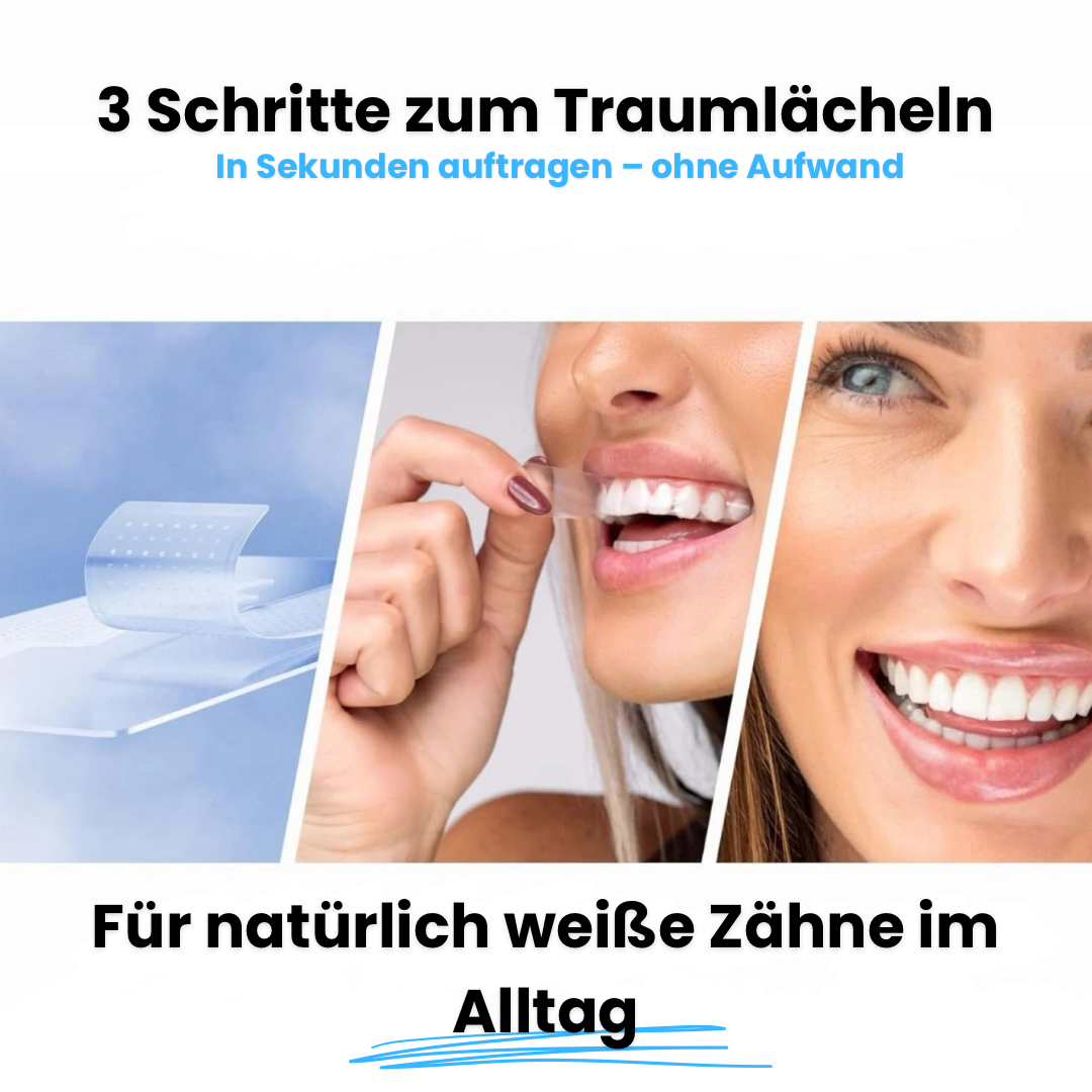 Shyne Strips - Aufhellungsstreifen